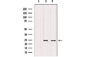 Western blot analysis of extracts from various samples, using RAB6A Antibody.