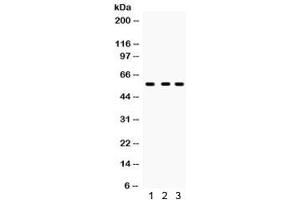 Western blot testing of 1) rat kidney, 2) mouse kidney and 3) 293 lysate with CYP27B1 antibody.