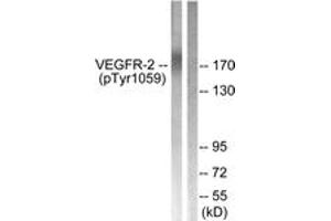 Western blot analysis of extracts from HepG2 cells treated with Na3VO4 0. (VEGFR2/CD309 Antikörper  (pTyr1059))