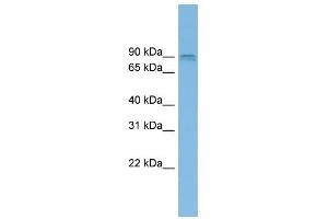 CENTG1 antibody used at 1 ug/ml to detect target protein.