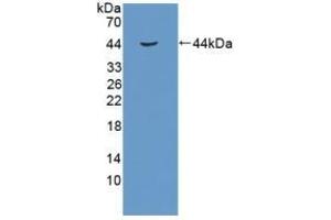 Detection of Recombinant RB1, Human using Polyclonal Antibody to Retinoblastoma Protein 1 (RB1) (Retinoblastoma 1 Antikörper  (AA 639-778))