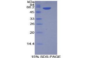 SDS-PAGE (SDS) image for Integrin alpha-9 (ITGA9) (AA 788-1030) protein (His tag,GST tag) (ABIN1878338)
