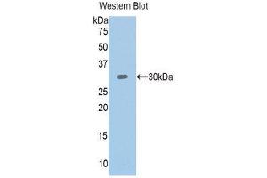 Western Blotting (WB) image for anti-Plastin 3 (PLS3) (AA 379-630) antibody (ABIN1111126)