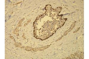 Immunohistochemistry (IHC) image for anti-Keratin 14 (KRT14) (AA 455-471), (C-Term) antibody (ABIN870552) (KRT14 Antikörper  (C-Term))