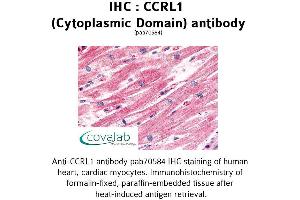 Image no. 1 for anti-Chemokine (C-C Motif) Receptor-Like 1 (CCRL1) (1st Cytoplasmic Domain) antibody (ABIN1732790) (CCRL1 Antikörper  (1st Cytoplasmic Domain))