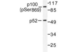 Image no. 1 for anti-Nuclear Factor of kappa Light Polypeptide Gene Enhancer in B-Cells 2 (NFKB2) (pSer869) antibody (ABIN318077) (NFKB2 Antikörper  (pSer869))