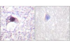 Immunohistochemistry analysis of paraffin-embedded human brain tissue, using E2F6 Antibody. (E2F6 Antikörper  (AA 141-190))