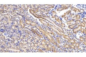 Detection of MCSFR in Mouse Kidney Tissue using Polyclonal Antibody to Colony Stimulating Factor Receptor, Macrophage (MCSFR) (CSF1R Antikörper  (AA 639-868))