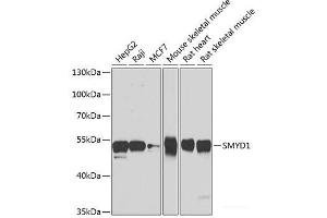 Western blot analysis of extracts of various cell lines using SMYD1 Polyclonal Antibody at dilution of 1:1000. (SMYD1 Antikörper)