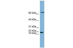 GM2A antibody used at 1 ug/ml to detect target protein.