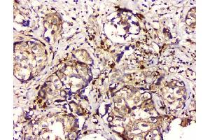 IHC analysis of GPX1 using anti GPX1 antibody (ABIN6719520). (Glutathione Peroxidase 1 Antikörper  (Middle Region))