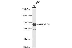 Western blot analysis of extracts of SH-SY5Y cells, using M antibody (ABIN6133958, ABIN6143567, ABIN6143569 and ABIN6224825) at 1:1000 dilution. (Tricellulin Antikörper  (AA 200-300))