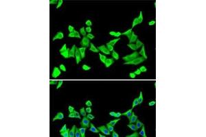 Immunofluorescence analysis of U2OS cells using PTH Polyclonal Antibody (PTH Antikörper)