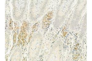ABIN6264305 and ABIN6272862 at 1/100 staining human normal colon tissue by IHC-P. (PLOD2 Antikörper  (C-Term))