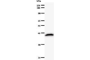 Western Blotting (WB) image for anti-Tax1 (Human T-Cell Leukemia Virus Type I) Binding Protein 1 (TAX1BP1) antibody (ABIN931085)