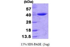 SDS-PAGE (SDS) image for Lactamase, beta (LACTB) (AA 20-377) protein (His tag) (ABIN667372)