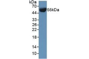 Detection of INV in Mouse Serum using Polyclonal Antibody to Involucrin (INV) (Involucrin Antikörper  (AA 301-460))