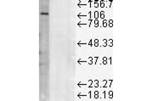 LAMP1 WB 1 in 1000 rat liver micosomes 20ug copy. (LAMP1 Antikörper)