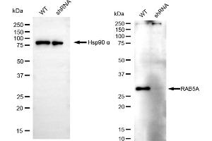Western blotting analysis using RAB5A antibody (ABIN7800099).