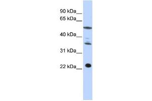 Western Blotting (WB) image for anti-Centromere Protein M (CENPM) antibody (ABIN2459009) (CENPM Antikörper)