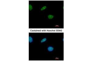 ICC/IF Image Immunofluorescence analysis of paraformaldehyde-fixed A549, using LXR beta, antibody at 1:500 dilution. (NR1H2 Antikörper  (N-Term))