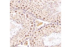 Immunohistochemistry of paraffin embedded mouse testis using DMRTA2 (ABIN7073753) at dilution of 1: 700 (400x lens) (DMRTA2 Antikörper)