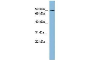 WB Suggested Anti-PRKCB1 Antibody Titration: 0. (Pkc beta 1 Antikörper  (N-Term))
