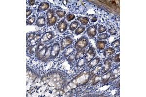 IHC analysis of TTK using anti-TTK antibody (ABIN7601844). (Mps1 Antikörper  (AA 487-821))