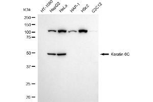 Western blotting analysis using Keratin 6C antibody (ABIN7799184).