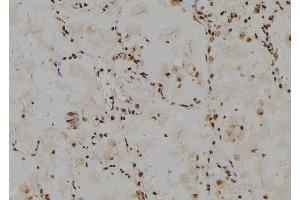 ABIN6274778 at 1/100 staining Human lung tissue by IHC-P. (RPL30 Antikörper  (C-Term))