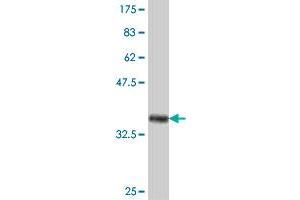 Western Blot detection against Immunogen (37. (PLAGL2 Antikörper  (AA 1-100))