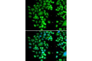 Immunofluorescence analysis of MCF7 cell using PHYHD1 antibody. (PHYHD1 Antikörper)
