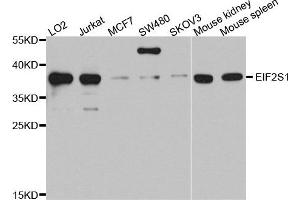 Western blot analysis of extracts of various cells, using EIF2S1 antibody. (EIF2S1 Antikörper)