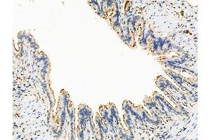 ABIN7094551 and ABIN7098600 at 1/100 staining Rat lung tissue by IHC-P.
