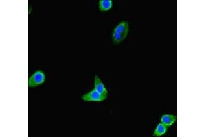 Immunofluorescent analysis of HepG2 cells using ABIN7172313 at dilution of 1:100 and Alexa Fluor 488-congugated AffiniPure Goat Anti-Rabbit IgG(H+L)