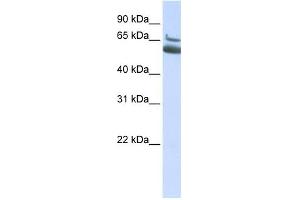 ALOX15B antibody used at 1 ug/ml to detect target protein. (ALOX15B Antikörper  (N-Term))