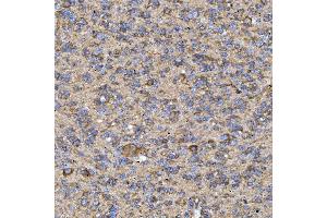 IHC analysis of RAB3GAP1 using anti-RAB3GAP1 antibody (ABIN7599702). (RAB3GAP1 Antikörper  (AA 109-810))