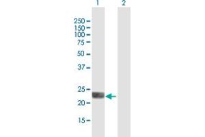 Western Blot analysis of LOH12CR1 expression in transfected 293T cell line by LOH12CR1 MaxPab polyclonal antibody. (LOH12CR1 Antikörper  (AA 1-196))