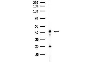 anti-Mevalonate Kinase (MVK) (Internal Region) antibody