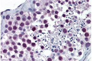 Human Testis: Formalin-Fixed, Paraffin-Embedded (FFPE) (ARNT Antikörper  (AA 1-110))