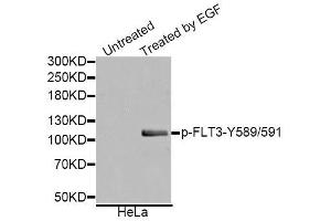 Western blot analysis of extracts of various cell lines, using Phospho-FLT3-Y589/591 antibody. (FLT3 Antikörper  (pTyr589, pTyr591))