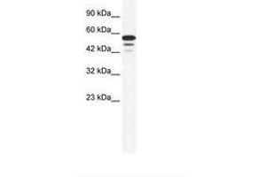 Image no. 1 for anti-Zinc Finger Protein 230 (ZNF230) (AA 133-182) antibody (ABIN6735984)