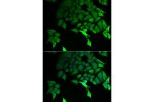 Immunofluorescence analysis of U2OS cell using TSC22D3 antibody. (TSC22D3 Antikörper)