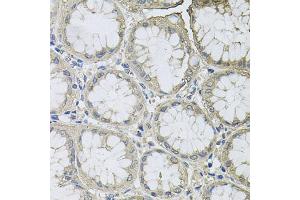 Immunohistochemistry of paraffin-embedded human stomach using BCL2L2 antibody (ABIN5970504) at dilution of 1/100 (40x lens). (BCL2L2 Antikörper)