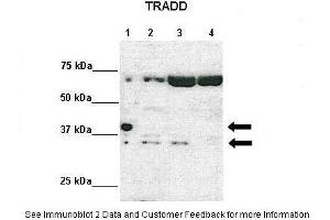 Lanes:   Lane 1: 10ug Tradd-HA-Strep-stable expression 293TREXFlpIn cells-Doxycycline induced Lane 2: 10ug ITradd-HA-Strep-stable expression 293TREXFlpIn cells-non-induced Lane 3: 10ug siRNA scrambled-MDA-MB-231 cells Lane 4: siRNA Tradd-MDA-MB-231 cells  Primary Antibody Dilution:    1:1000  Secondary Antibody:   Anti-rabbit HRP  Secondary Antibody Dilution:    1:2000  Gene Name:   TRADD  Submitted by:   Dr. (TRADD Antikörper  (Middle Region))
