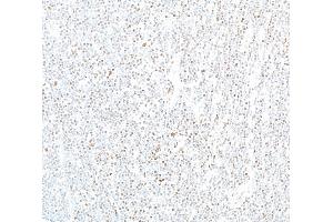 Immunohistochemistry (IHC) image for anti-Ataxia Telangiectasia Mutated (ATM) (AA 2550-2600) antibody (ABIN7795796)