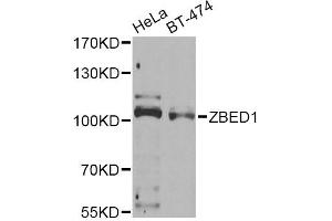 Western blot analysis of extracts of various cell lines, using ZBED1 Antibody (ABIN2560810) at 1:1000 dilution. (ZBED1 Antikörper)