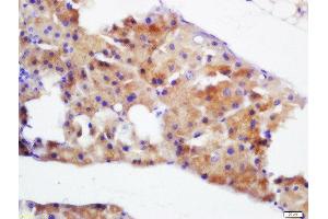 Formalin-fixed and paraffin embedded mouse pancreas labeled with Rabbit Anti-Pancreatic Amylase Polyclonal Antibody, Unconjugated  at 1:200 followed by conjugation to the secondary antibody and DAB staining