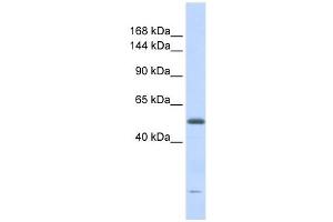 DNA2L antibody used at 1 ug/ml to detect target protein. (DNA2 Antikörper  (Middle Region))