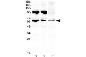 Western blot testing of 1) rat liver, 2) mouse liver and 3) human HepG2 lysate with PLIN1 antibody at 0. (PLIN1 Antikörper)